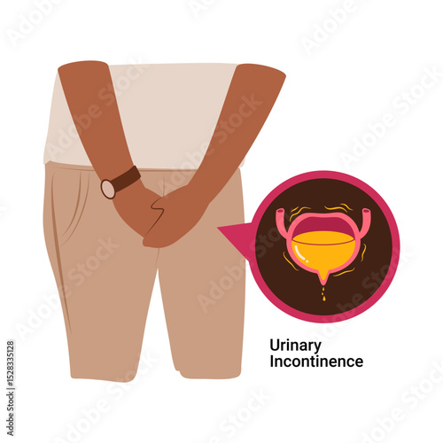 Man having Urinary Incontinence. Overactive bladder. Bladder disease illustration 