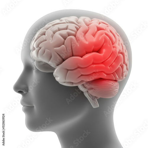 Brain inflammation illustration headache migraine medical concept on transparent background