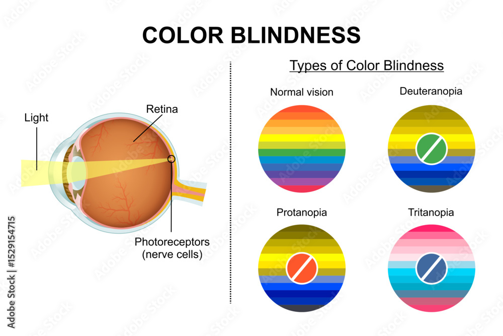 Foto Color Blindness and its testing types illustration