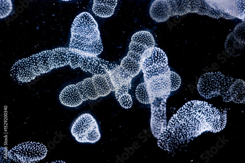 A colony of Rhizaria, an important group of large zooplankton Rhizaria make up some 33 percent of large zooplankton in the ocean, and more than 5 percent of the total marine biomass