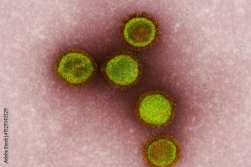 A colorized electron microscope image of Epstein–Barr virus (EBV) particles, showing spherical green-yellow virions with dark edges on a soft pink and purple cellular background.  photo