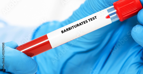 Billede på lærred Barbiturates Test
