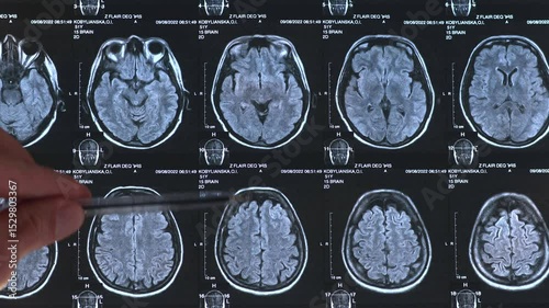 Close up view of CT scan image human brain. 4k footage.