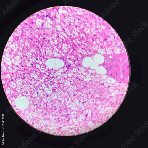 Micrograph of stellate hepatic cells