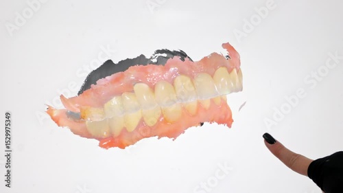 3D dental scan showing upper and lower jaw with implants and gums, Digital dentistry image displays gum tissue, teeth structure and restoration elements