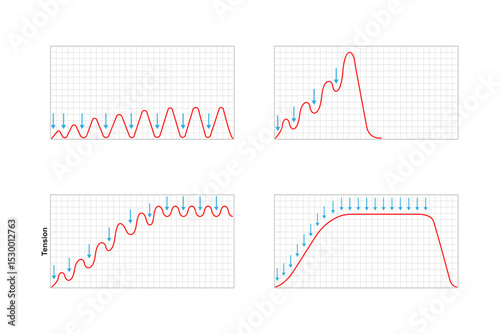Types of Muscle Response Science Design. Vector Illustration.	