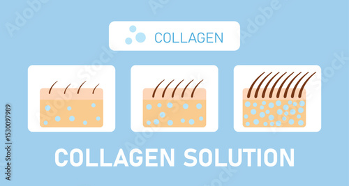 Collagen Solution, Hair Growth Stages Vector Infographic, Protection Skin