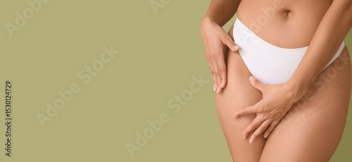 Fotografie Beautiful young woman with stretch marks on her body against green background wi