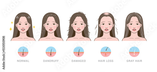 Types of hair problems. Normal, dandruff, damaged, hair loss, and gray hair.
