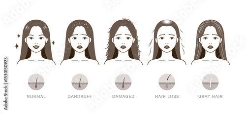 Types of hair problems. Normal, dandruff, damaged, hair loss, and gray hair.