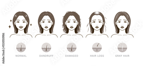 Types of hair problems. Normal, dandruff, damaged, hair loss, and gray hair.