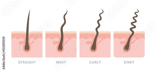 Hair types with follicles vector illustration. Cross section of straight, wavy, curly, kinky and coily hair with scalp layer. Types of hair set. Hair anatomy concept.