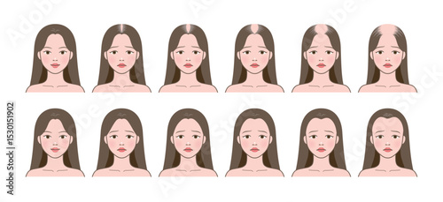 Stages of baldness of women. Female character head top view with hair loss process. Aging problems, alopecia.