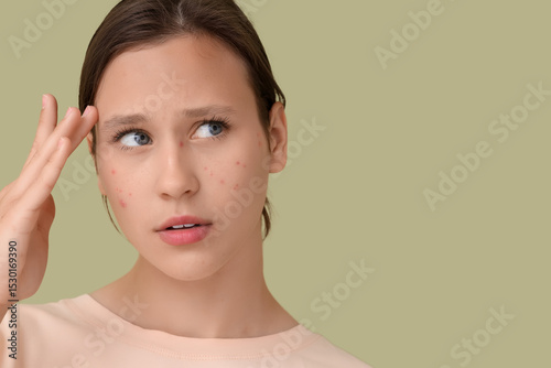 Young woman with acne and s...