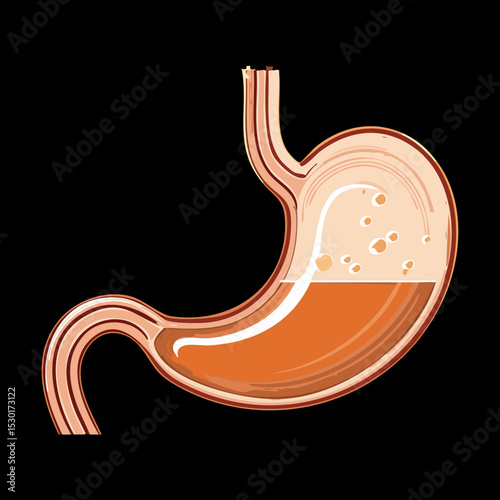 Stomach with Chunky Digested Food Particles