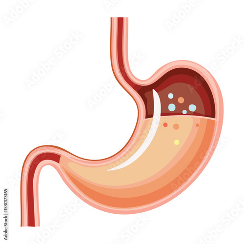 Stomach with Dark Liquid and Solids