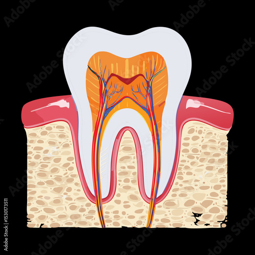 Dental Caries Progression Through Tooth Layers