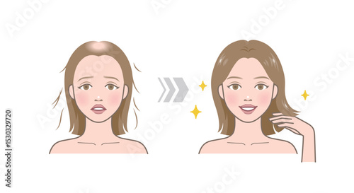 Before and after of hair loss versus hairy. Woman character with hair problem of baldness. Hair regrowth.