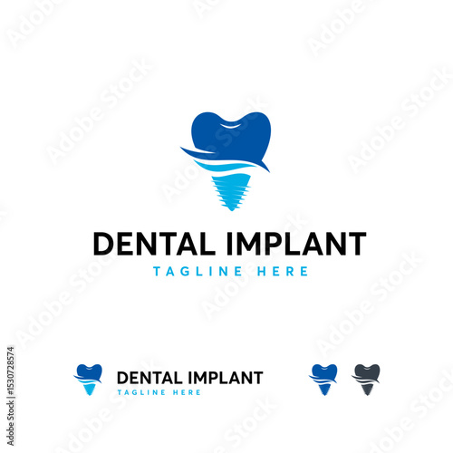A dental implant  design.
