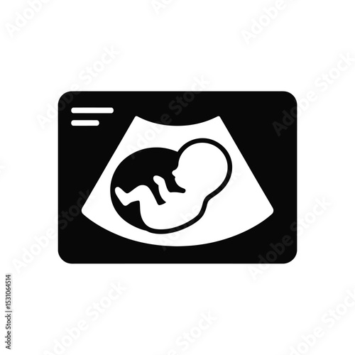 Black and white ultrasound image of a fetus in womb