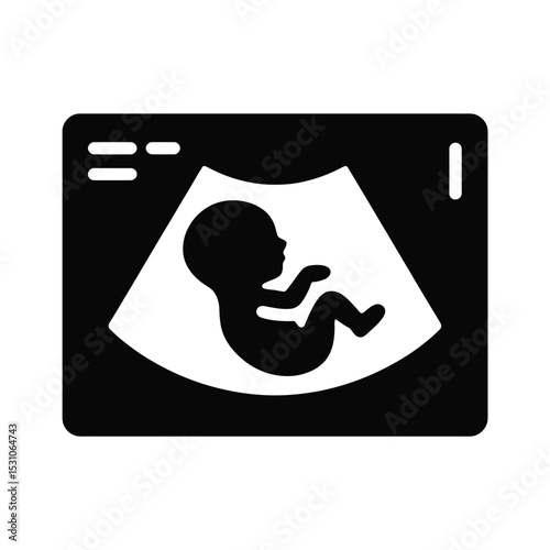 Black and White Ultrasound Image of a Fetus Silhouette