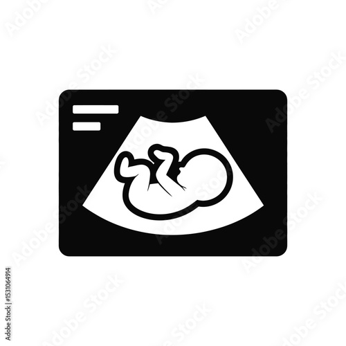 Black and White Ultrasound Image of a Fetus in the Womb