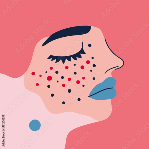 Minimalist vector illustration of female face profile with acne pimples, closed eye with long eyelashes, blue lips on pink background, skincare concept