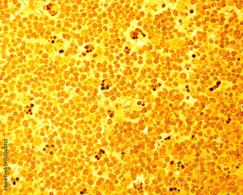 Wallpaper Mural Lymphoid tissue. Macrophages Torontodigital.ca