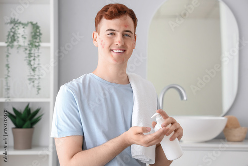 Teenage boy with remedy for...