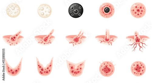 Vector Icons Set of Detailed Medical Illustration of Skin Conditions and Dermatological Issues. Vector Illustrations