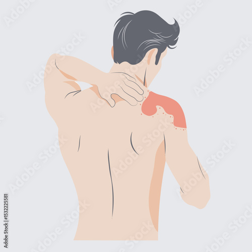 Autoimmune progesterone dermatitis,urticaria,Bullous pemphigoid,herpetiformis,Dermatomyositis,Epidermolysis bullosa acquisita,Gestational,Hidradenitis suppurativa,Lichen planus,Linear IgA,Psoriasis