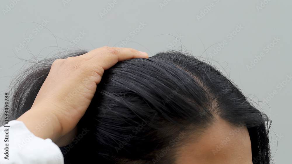 Fototapeta premium Woman with hair loss dryness and frizziness