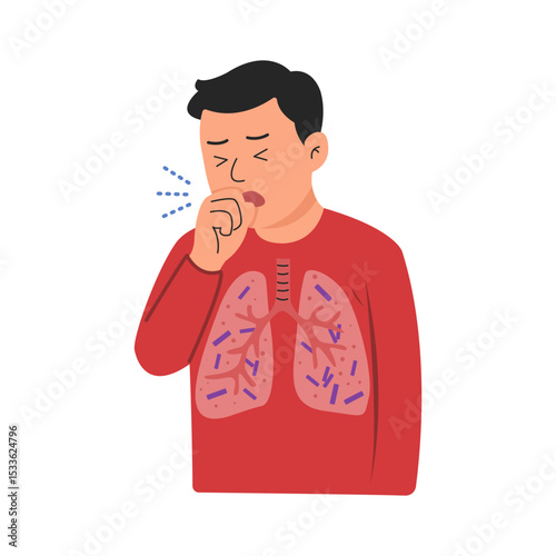 mycobacterium tuberculosis infection disease concept.