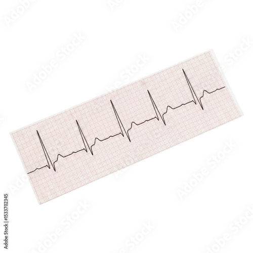 Electrocardiogram printout showing regular heartbeat on graph paper transparent PNG