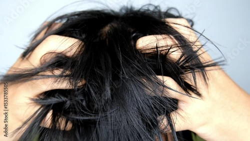 Close up of person scratching itchy scalp with both hands, showing signs of discomfort and irritation, highlighting hair and scalp health issues.