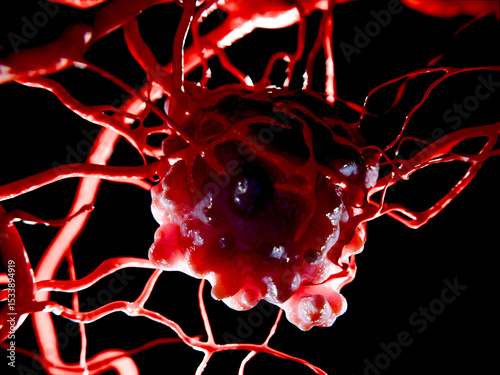 Growing tumor, angiogenic switch and neovascularization