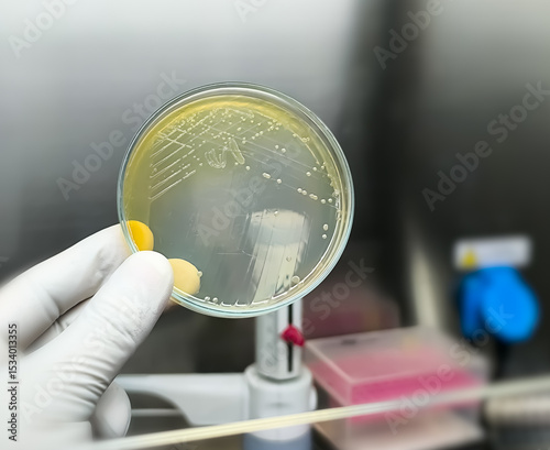 Colony of Burkholderia mallei, a Gram-negative, bipolar aerobic bacterium. B. pseudomallei