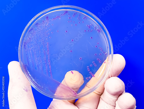 A microbiological culture Petri dish with a colonies of the pathogenic bacterium Escherichia coli (E. coli)