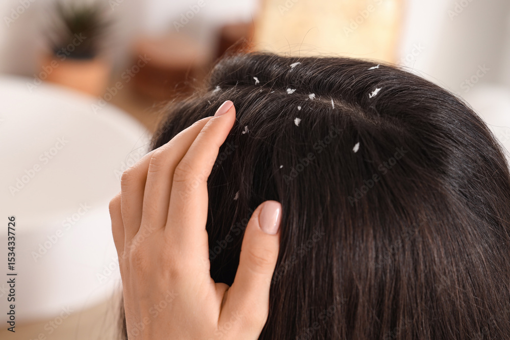 Fototapeta premium Young woman with dandruff problem in light bathroom, closeup