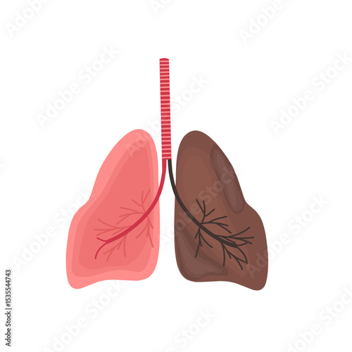 Illustration of unhealthy lungs. Illustration of damaged lungs due to smoking. Illustration of dirty lungs. Vector illustration of lungs 