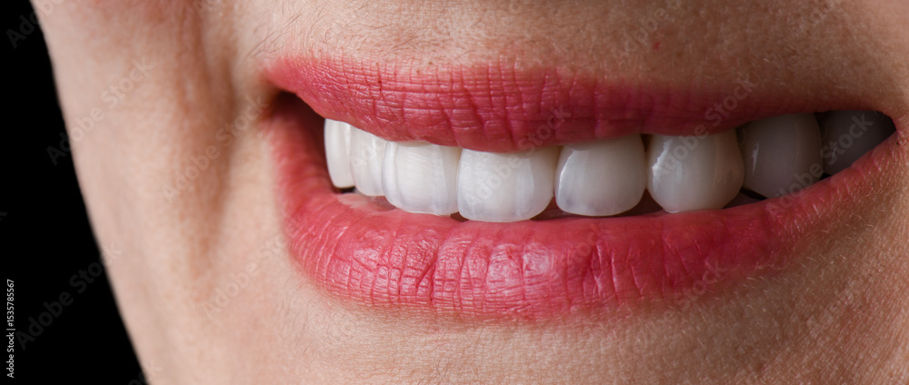 Obraz premium ceramic crowns and veneers