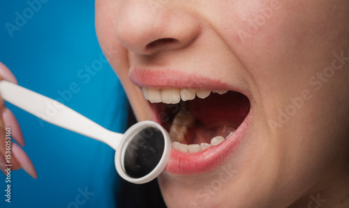 Dental clinic. Close up teeth with dental mirror. Ideal white teeth. Dental treatment. Teeth examined at dentists. Healthy woman teeth and a dentist mouth mirror. Dental tools white tooth.
