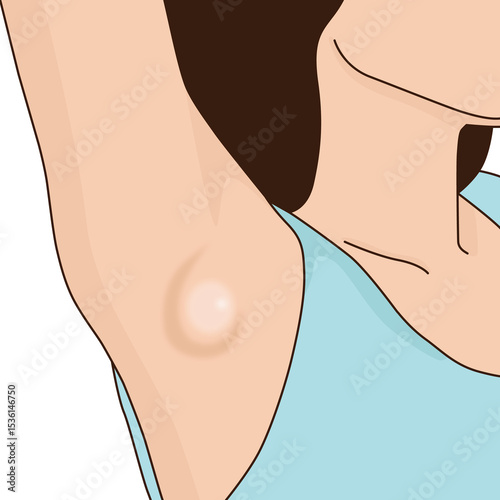 Fotografie Woman raise hand up has lump in armpit inflammation, illustration on white backg