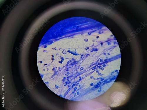 cells under a microscope, inflammation, cancer, neutrophils, macrophages