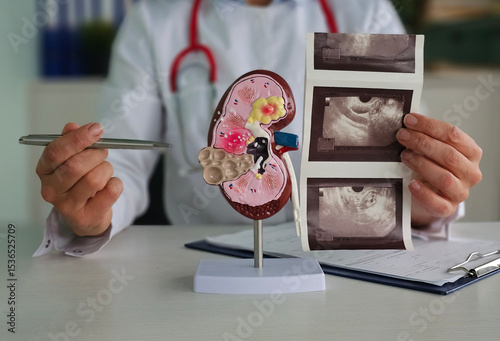 Doctor examining kidney model while reviewing ultrasound images