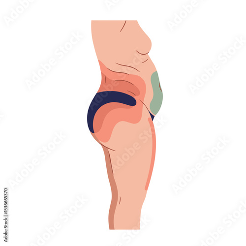 Illustration of human body showing fat storage in side profile  
