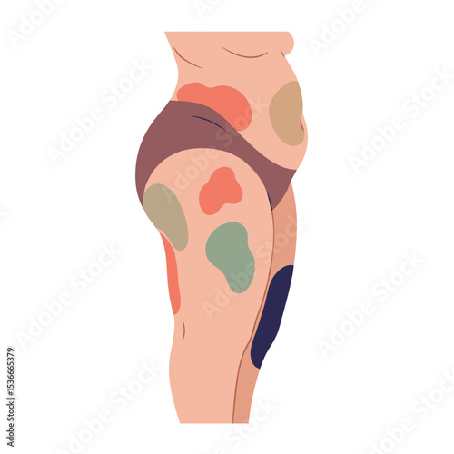 Abstract illustration of a woman's thigh with colorful fat deposits  