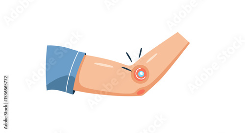 Illustration of arm with a small red inflamed spot on elbow  