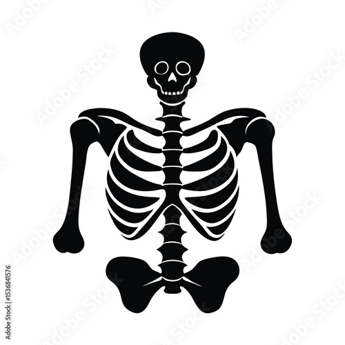 X Ray Image Showing Uranium Bone Effects
