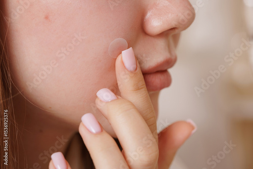 Closeup of girl applying hydrocolloid acne patch on face, highlighting skincare, blemish treatment, and selfcare routine for clear, healthy skin.
